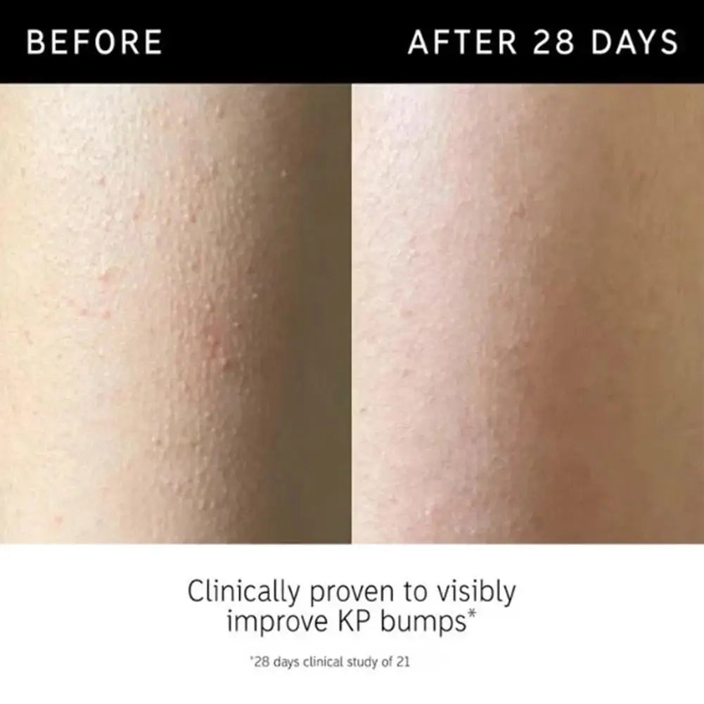 Exfoliating Body Stick Moisturizer - Natural Cruelty-Free Black Formula Scrubs Treatments Tidesmit
