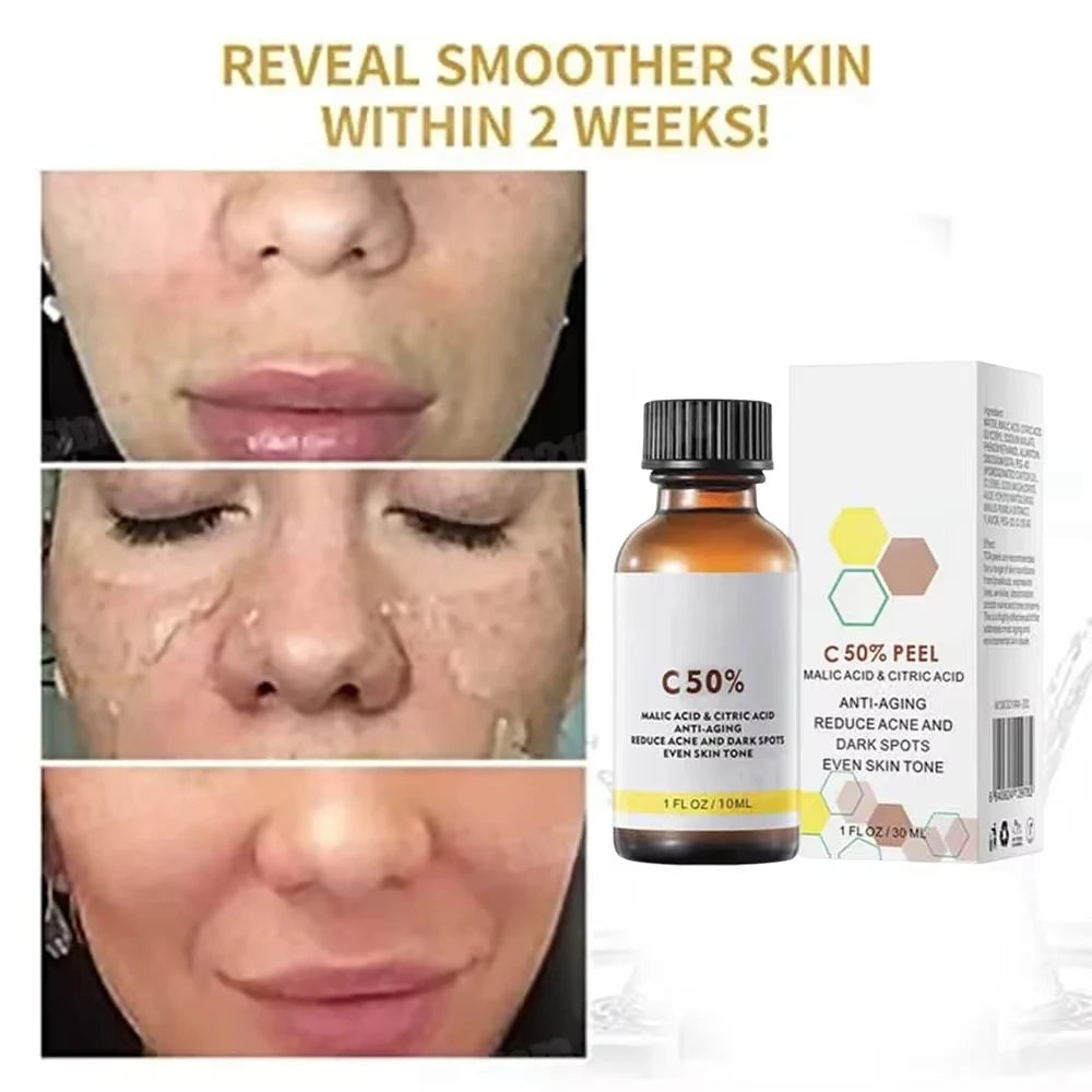 Salicylic Acid Peeling Lotion for Dark Skin | Professional Exfoliation Scrubs Treatments Tidesmit