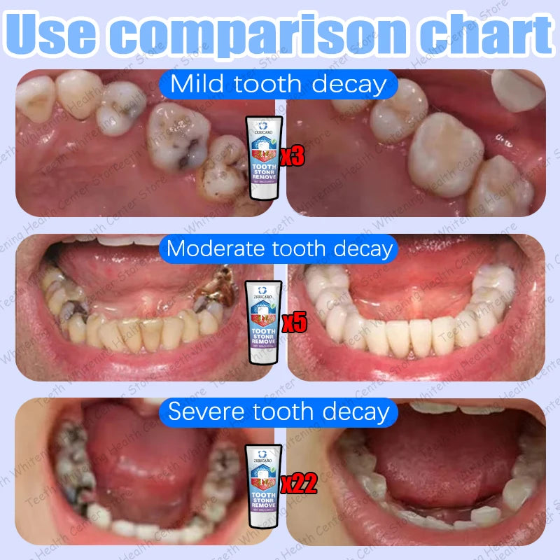Tooth Decay Repair Treatment - Natural Oral Care Serum by Tidesmit Scrubs Treatments Tidesmit