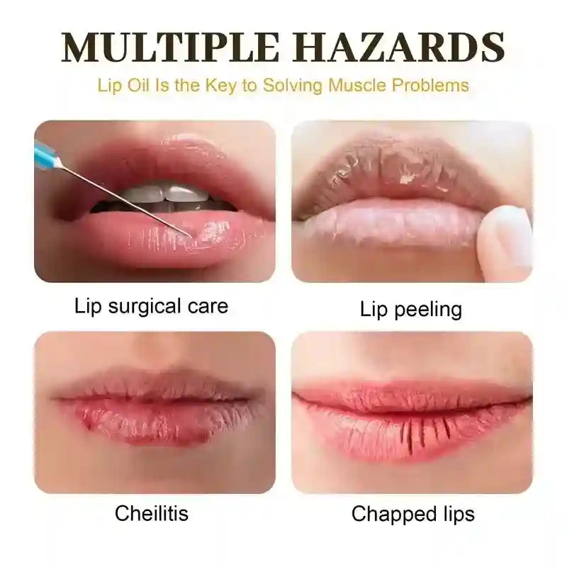Dark Lip Lightening Balm - Exfoliating Nourishing Lip Treatment Lip Care Tidesmit