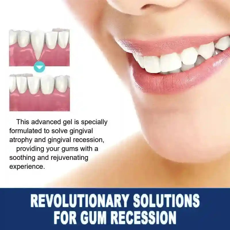 Gingival Barrier Gel for Professional Teeth Whitening - 5PCS Set Lip Care Tidesmit