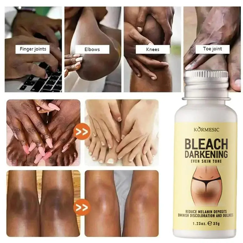Body Whitening Cream Private Parts Underarm Dark Skin Bleaching Serum Niacinamide Whitening Lighten Dark Spots Snow Bleach Cream