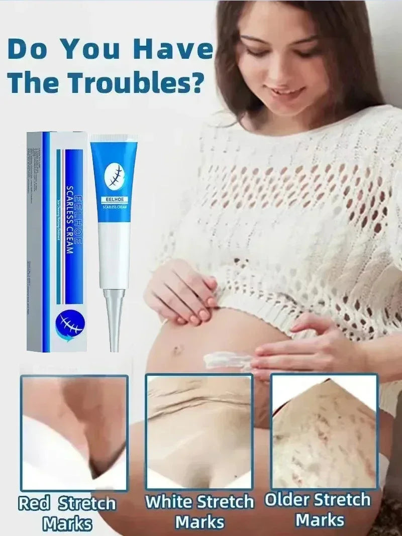 Stretch Mark Repair Cream for Pregnancy Postpartum Skin Recovery Relaxation Treatment Tidesmit
