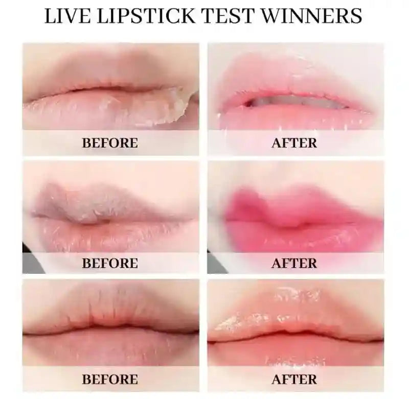 Pink Lip Lightening Serum for Dark Lips - Moisturizing Lip Care Lip Care Tidesmit