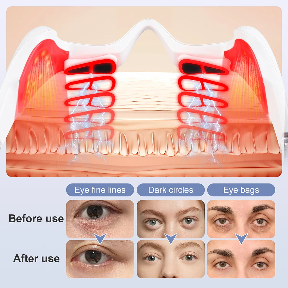 White electric under-eye massager with red light therapy for reducing fine lines, dark circles, and puffiness.