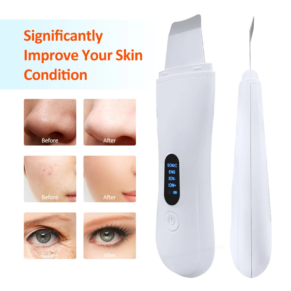 Ultrasonic Skin Scrubber Facial Cleanser - White Professional Care Scrubs Treatments Tidesmit