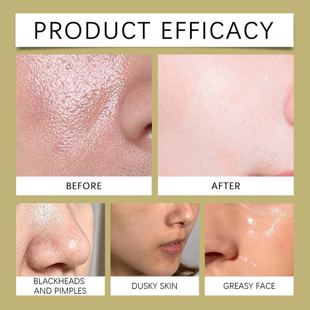 Facial Exfoliating Scrub for Deep Pore Cleansing | Tidesmit EU Scrubs Treatments Tidesmit