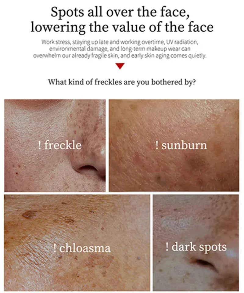Dark Spot Corrector Cream for Pigmentation & PMU Aftercare | Tidesmit Permanent Makeup Machines Tidesmit