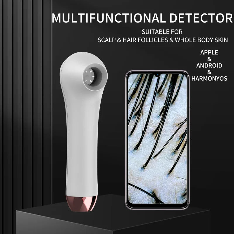 White HD scalp and hair follicle detector with smartphone display showing magnified skin analysis for home use.
