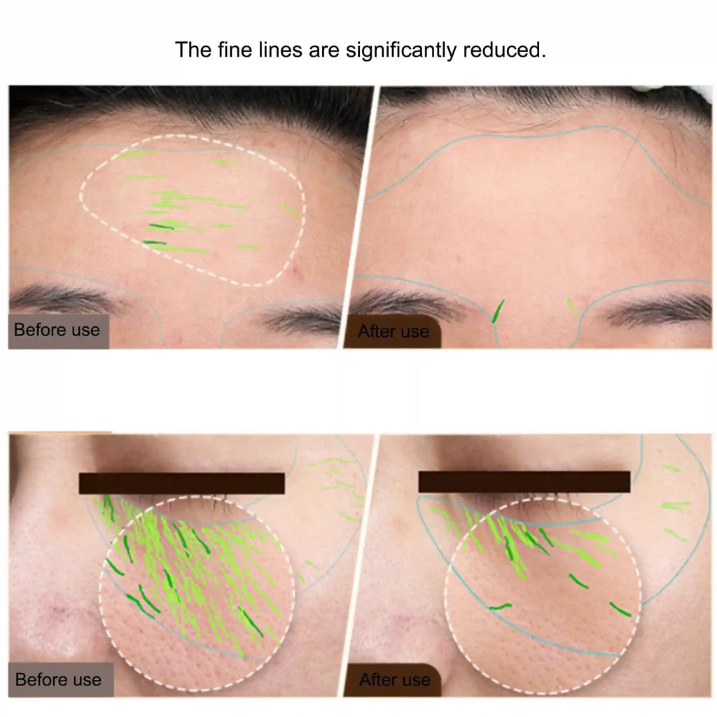 EMS Facial Lifting Device - Professional Skin Tightening & Toning Eye Massage Instrument Tidesmit