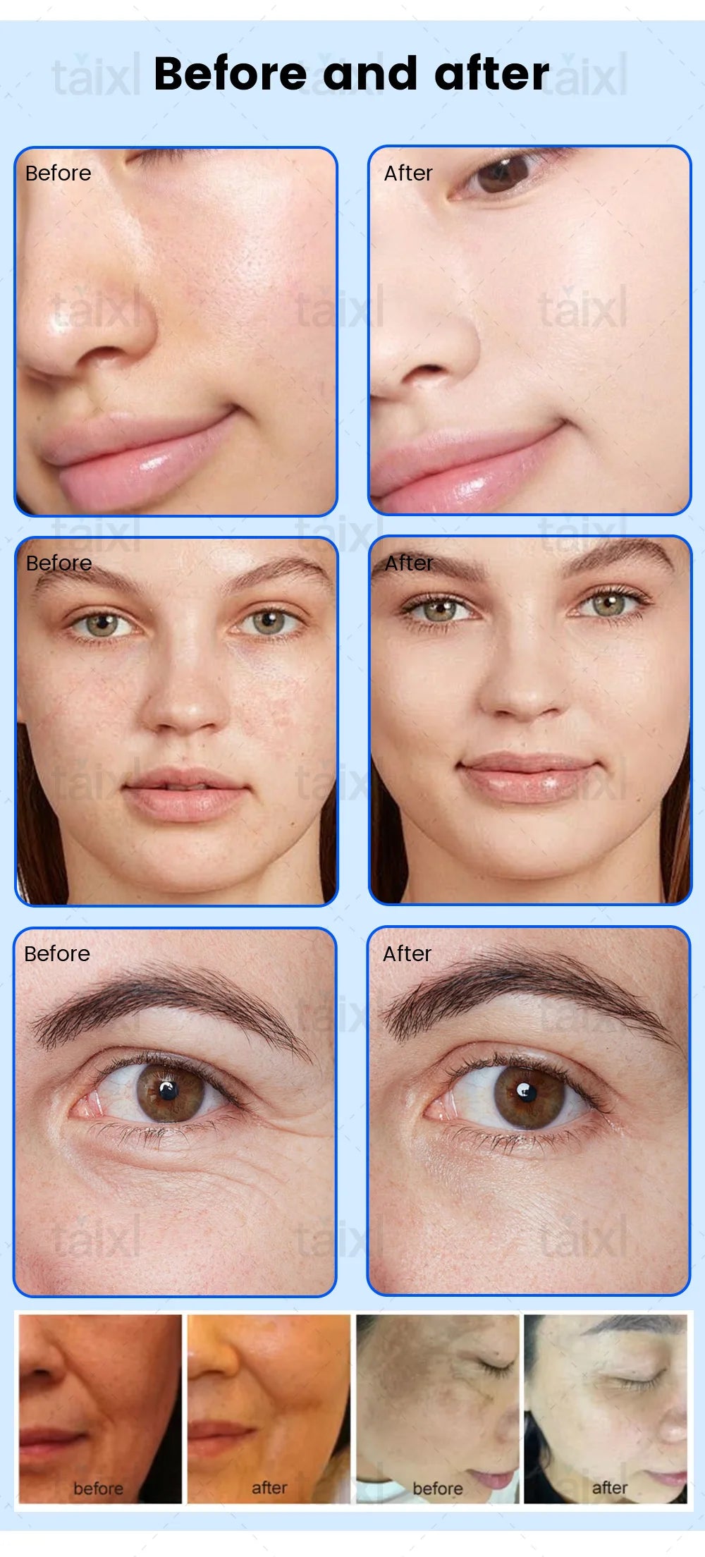 Cold Hot Plasma Machine for Facial Care and Skin Rejuvenation - Tidesmit Body Shaping Massage Equipment Tidesmit